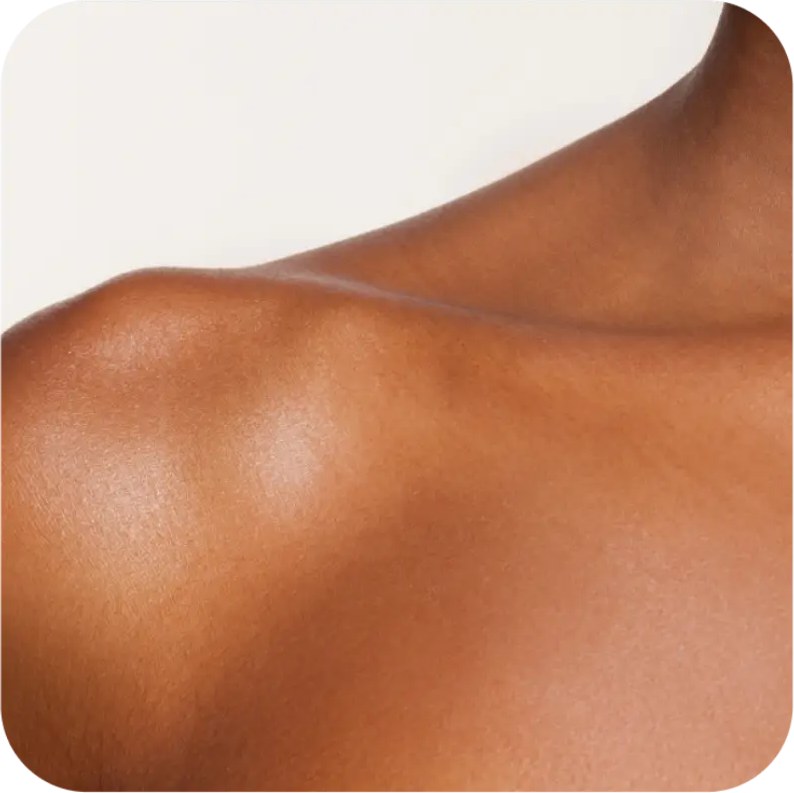 Adenomyosis Symptoms & Treatment